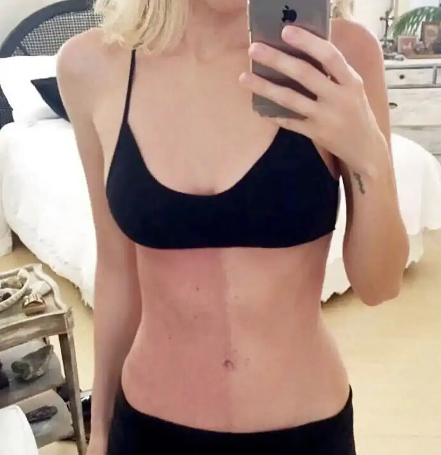 A person's upper body showing chimerism with two distinct skin color tones split down the middle. A person's upper body showing chimerism with two distinct skin color tones split down the middle.