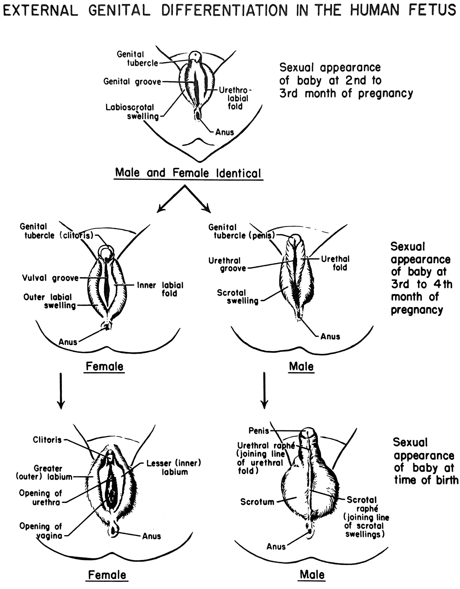 A detailed medical diagram shows three stages of differentiation of a baby’s external genital organs. It shows how there is a common sexual appearance of the baby at the second to third month of pregnancy which then starts to differentiate (between a vulval groove and urethral groove) at the third to fourth month of pregnancy to finally the fully formed external genital organs at the time of birth. A detailed medical diagram shows three stages of differentiation of a baby’s external genital organs. It shows how there is a common sexual appearance of the baby at the second to third month of pregnancy which then starts to differentiate (between a vulval groove and urethral groove) at the third to fourth month of pregnancy to finally the fully formed external genital organs at the time of birth.